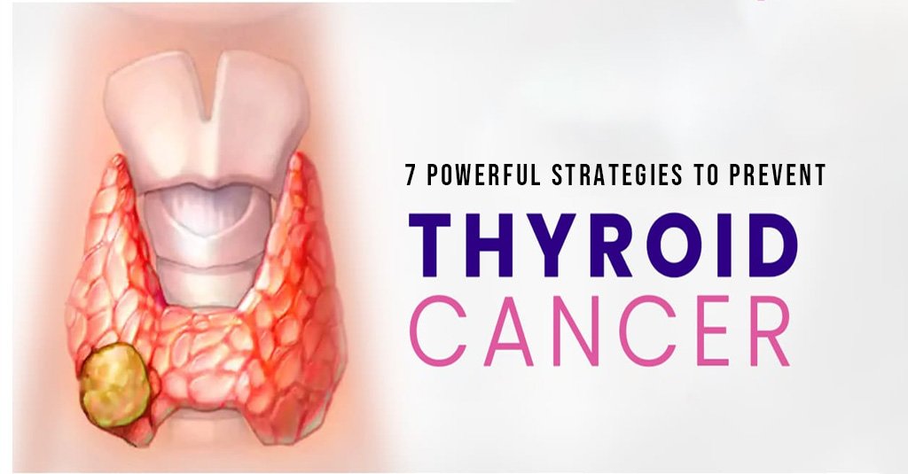 thyroid cancer