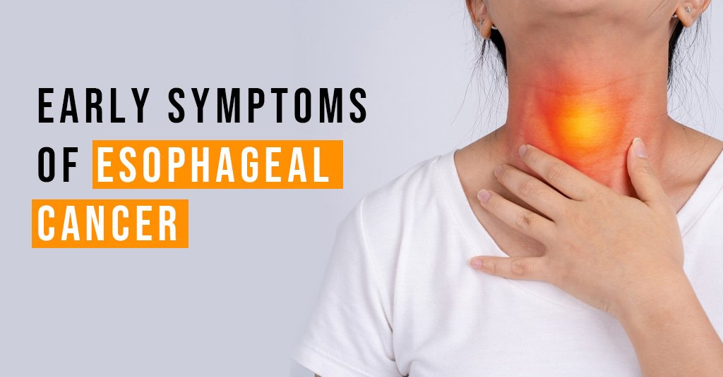 Esophageal Cancer Guide: 4 Symptoms, Causes, and Prevention Tips | Dr. Anvesh Dharanikota, Hyderabad